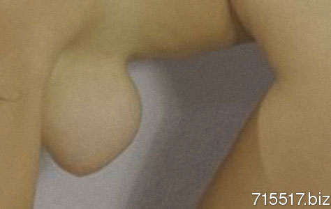 Chapallone