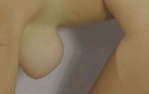 Chapallone